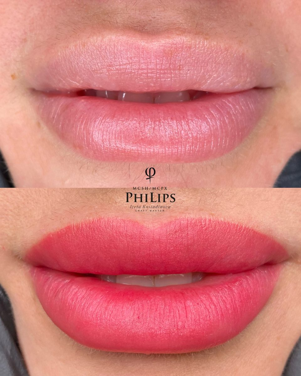 PhiLips преди и след